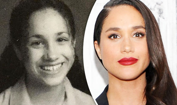 Transformacija Meghan Markle - operirala je nos?!