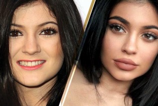 Kylie Jenner više se ne srami svojih prirodnih usana i izgleda bolje nego ikad