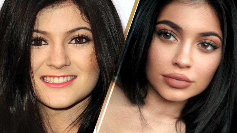 Kylie Jenner više se ne srami svojih prirodnih usana i izgleda bolje nego ikad
