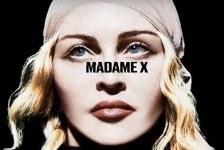 Madonnu stižu godine: Aktualna turneja više puta prekinuta, tretmani oporavka su ekstremni
