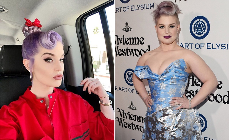 Kelly Osbourne priznala da joj je operacija pomogla u gubitku kilograma