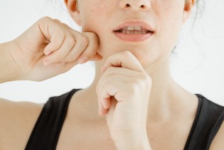 Botoks bez igala: Osježite svoju kožu uz ove jednostavne vježbe