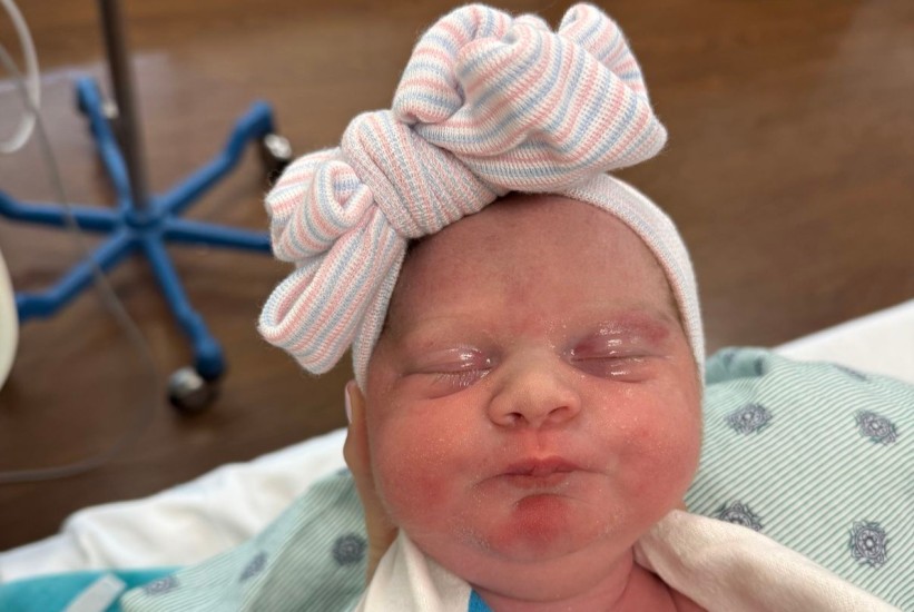 Hematom na glavi novorođenčeta nakon poroda: Da li treba brinuti?