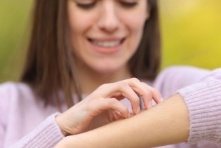 Zašto nas svrbi ubod insekta?