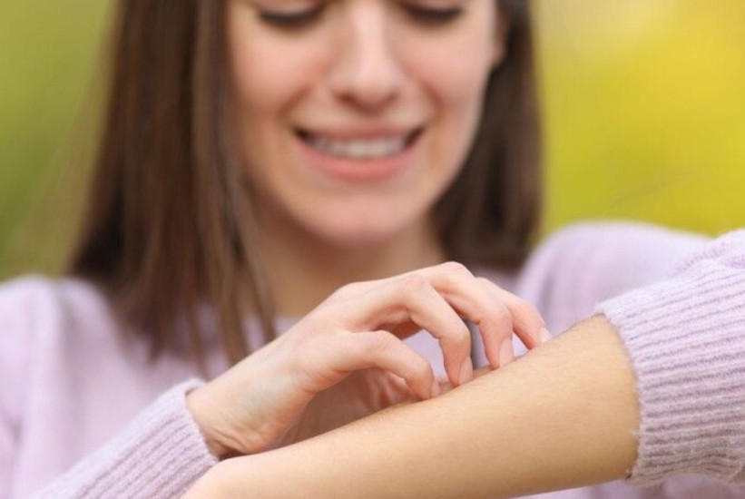 Zašto nas svrbi ubod insekta?